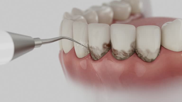 Reliable Dental contractor in Boardman, OR by Smile Center Dentistry